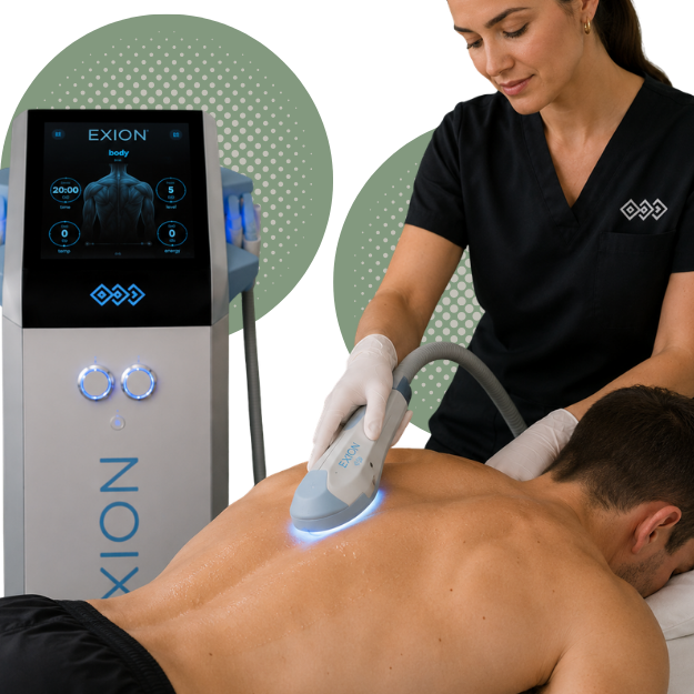 Provider performing Exion RF treatment for skin tightening and rejuvenation